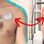 Kalp Pili Takan Kişiler Elektrikli Araç Kullanabilir mi?