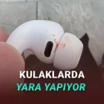 AirPods Pro 3'ün Kulaklarda Yara Yaptığı İddia Edildi: İşte Muhtemel Nedeni