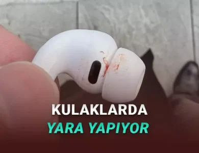 AirPods Pro 3'ün Kulaklarda Yara Yaptığı İddia Edildi: İşte Muhtemel Nedeni