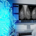 Meme Kanseri, Google'ın Yapay Zekası ile Tespit Edilecek