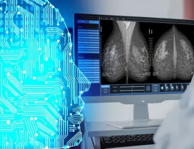 Meme Kanseri, Google'ın Yapay Zekası ile Tespit Edilecek